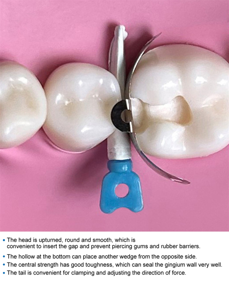 Dental Matrix Bands Ring Sectional Matrice Clamp Fit Garrison Palodent V3 System