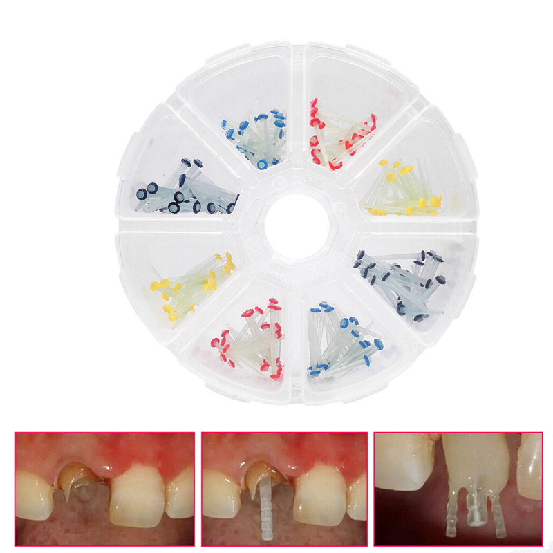 200 Pcs Dental Fiber Post Glass Quartz Teeth Restorative 1.0 1.2 1.4 1.6 1.8mm