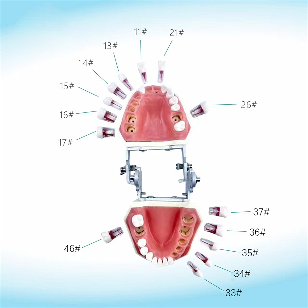 10Pcs Dental Endo Root Canal Teeth Model Study RCT Practice Typodont Model