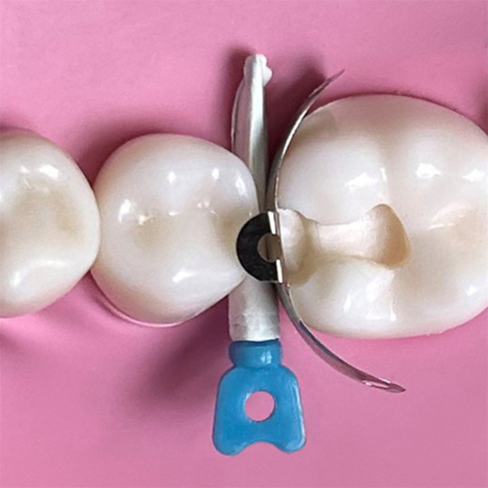 Dental Matrix Bands Ring Sectional Matrice Clamp Fit Garrison Palodent V3 System