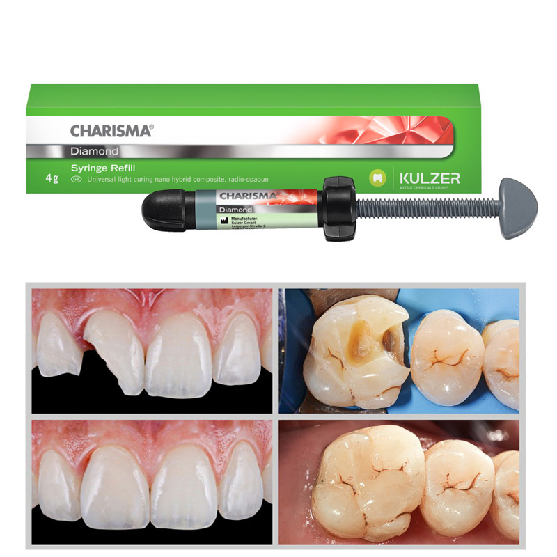KULZER CHARISMA Diamond Dental Light Cure Composite Resin A2,A3,A3.5,OM,OB,BL,BXL