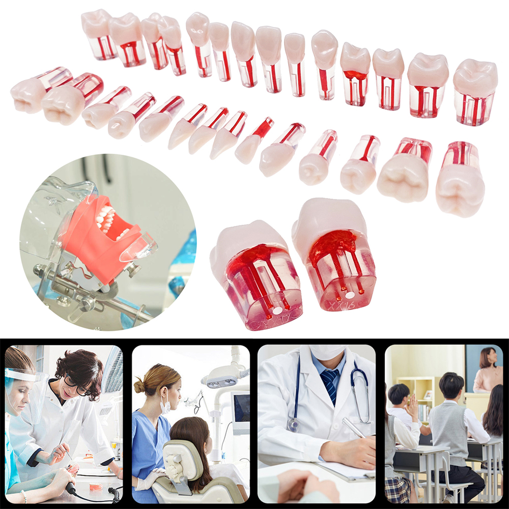 28Pcs/Set Dental Endo Root Canal Endodontic Teeth Teach Model Resin Study Tooth