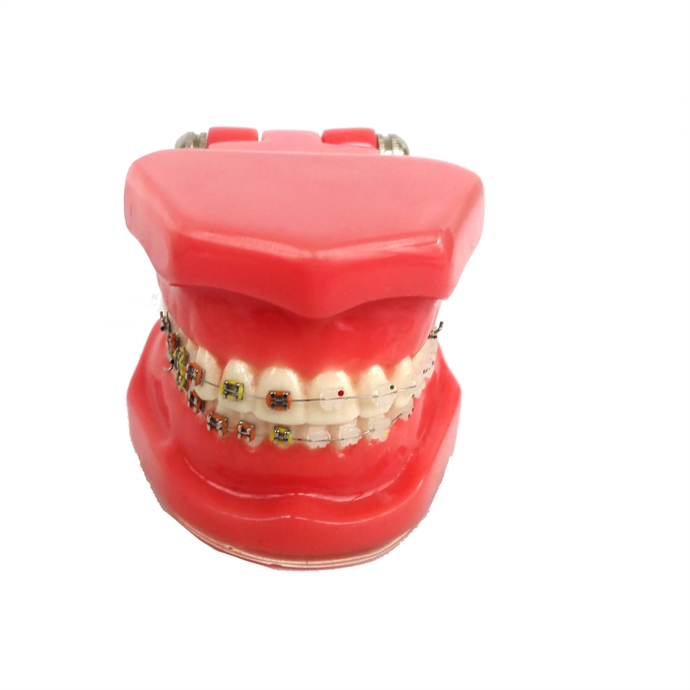 Dental Teeth Model Study Orthodontic Removable Teeth Implant Teaching Model