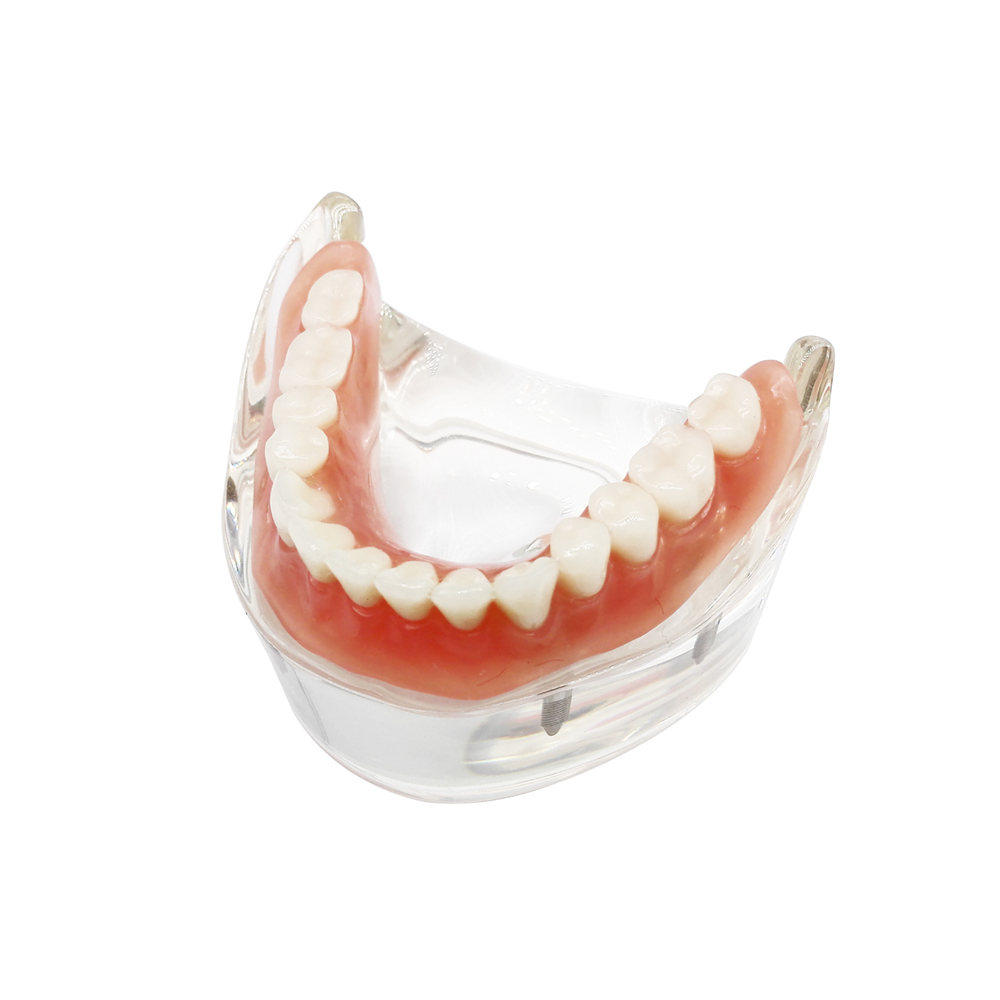 Dental Teeth Model Study Orthodontic Removable Teeth Implant Teaching Model