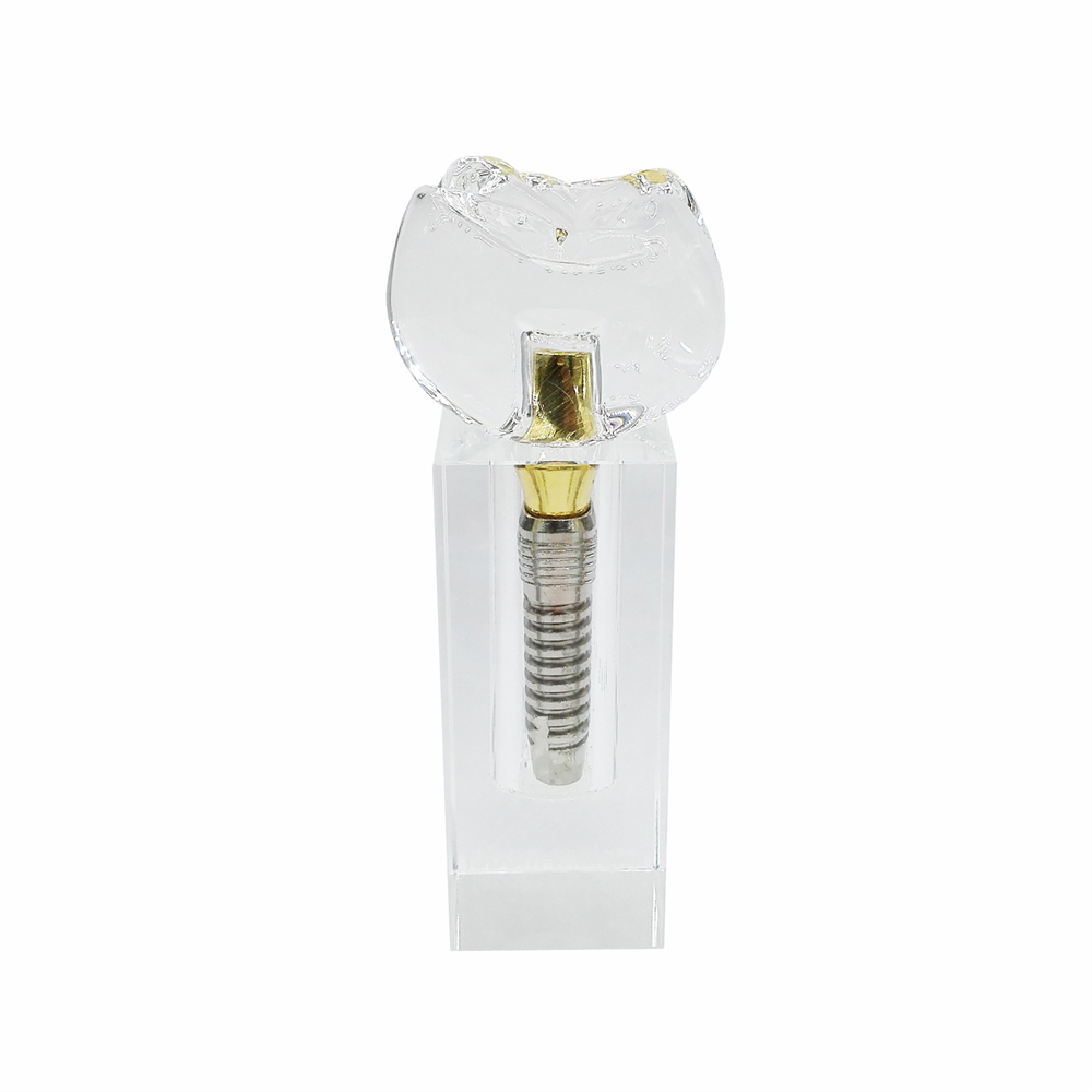 Dental Teeth Model Study Orthodontic Removable Teeth Implant Teaching Model