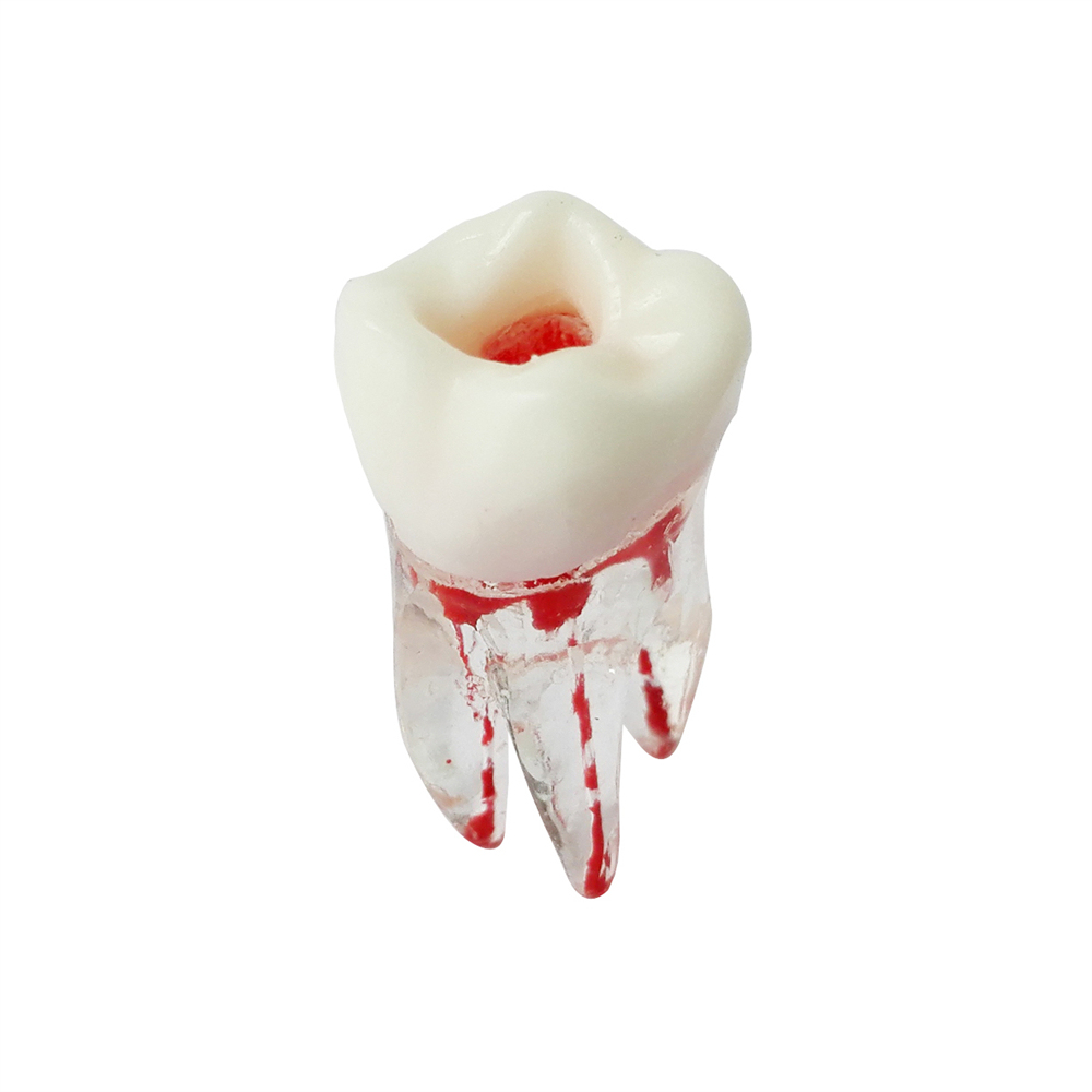 Dental Teeth Model Study Orthodontic Removable Teeth Implant Teaching Model