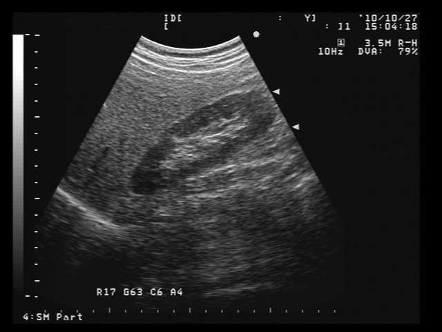 AL3C79B (UST-979 Replacement)