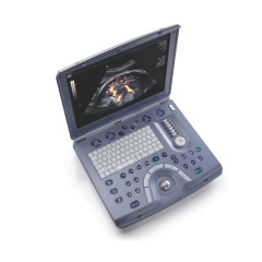 GE Voluson I Ultraschallsystem