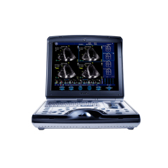 GE Vivid i Portable Cardiac Ultrasound Machine