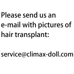 Other Hair Transplant Styles(+$49)
