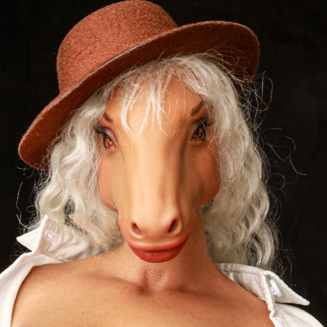Maureen (hair transplant) (paid option)