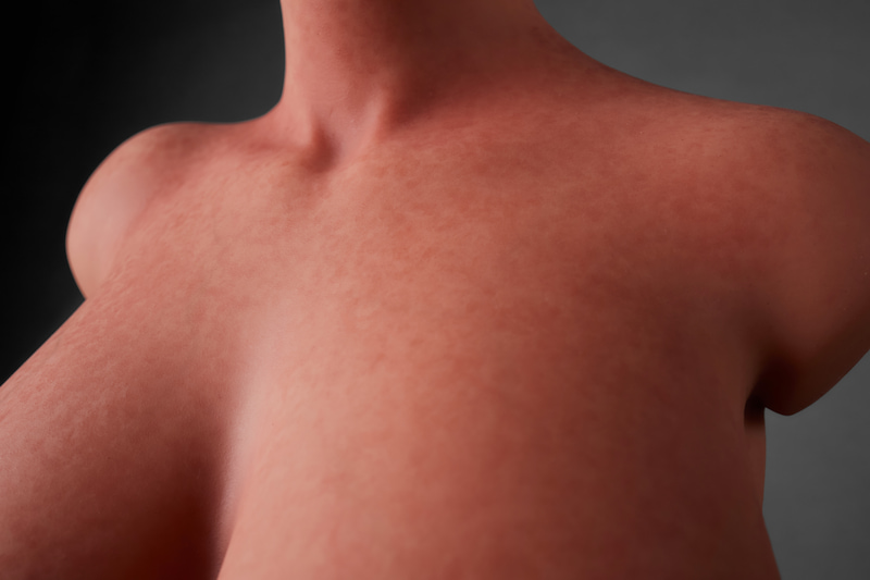 ULW 883# Fiora: This close-up highlights the neck and delicate collarbone lines of a headless half-body torso, showcasing rounded shoulder contours and healthy-toned skin realistically detailed by dense, fine freckles and textures.