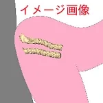 ①性器と肛門が別タイプ