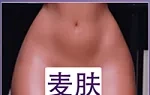 小麦肌