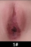 #1