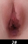 #2