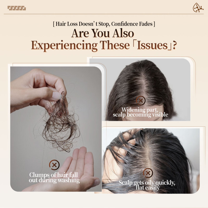 Herbal Ginseng Ginger Oil Control Anti-Hair Loss Shampoo Scalp Care Vegan Nourishing Smoothing Shampoo for All Hair Types