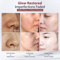 FERBOH Wholesale Moisturizing Anti Aging Whitening Fade Dark Spot Anti Freckle Lotion Nicotinamide Anti Spots Face Cream