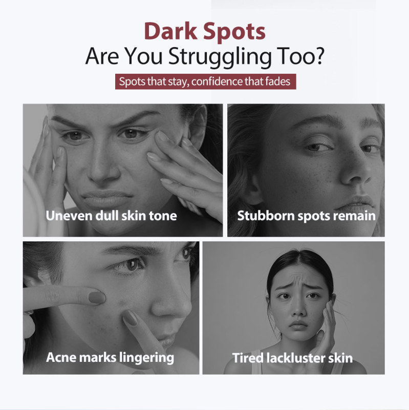 FERBOH Wholesale Moisturizing Anti Aging Whitening Fade Dark Spot Anti Freckle Lotion Nicotinamide Anti Spots Face Cream