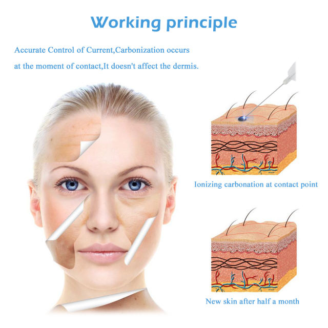 Fibroblast Plasma Pen Eyelid Wrinkle Removal Plasma Pen Skin Spot Wart Tattoo Mole Remover Cleaning Beauty Salon Machine