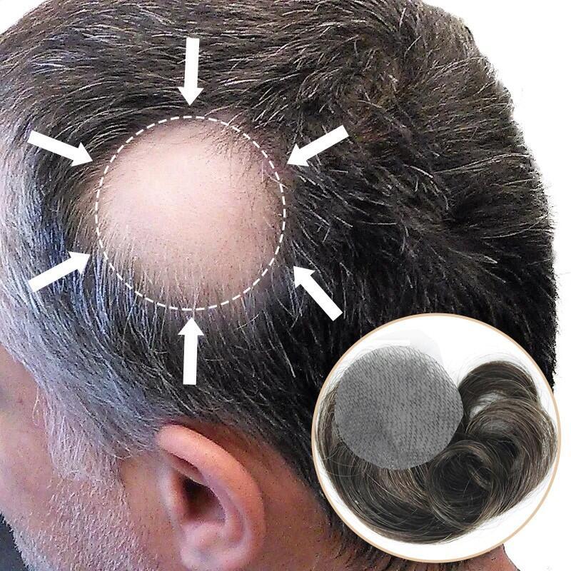 Men's Hairpiece Side Or Back Hair Patches For Men To Cover Bald Spot On Head Side Or Back