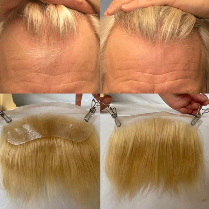 Transparent HD Invisible Lace Front Hairline French Lace Front Mens Toupee Frontal Hairpiece for Receding Natural Hairline V-Shape Lace Poly PU Forehead Human Hair Replacement System Blonde 613