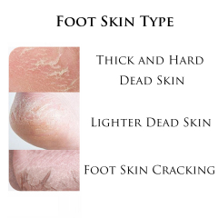 Stainless Steel Foot File Pedicure with Collecting Cover Remove Hard Skin
