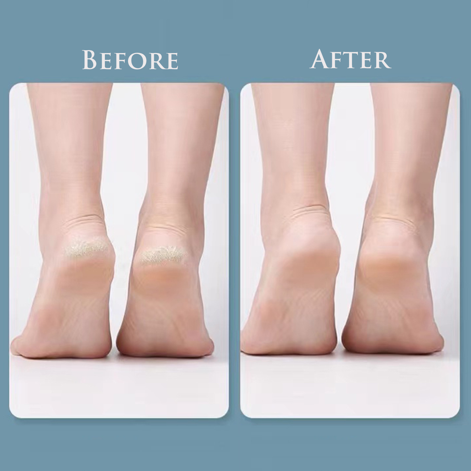 Foot File Callus Remover for Dead Skin, Double Side Metal Foot File Stainless Steel Pedicure Foot Rasp Foot Scraper to Remove Hard Skin Cracked Heel