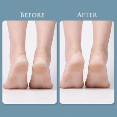 Foot File Callus Remover for Dead Skin, Double Side Metal Foot File Stainless Steel Pedicure Foot Rasp Foot Scraper to Remove Hard Skin Cracked Heel