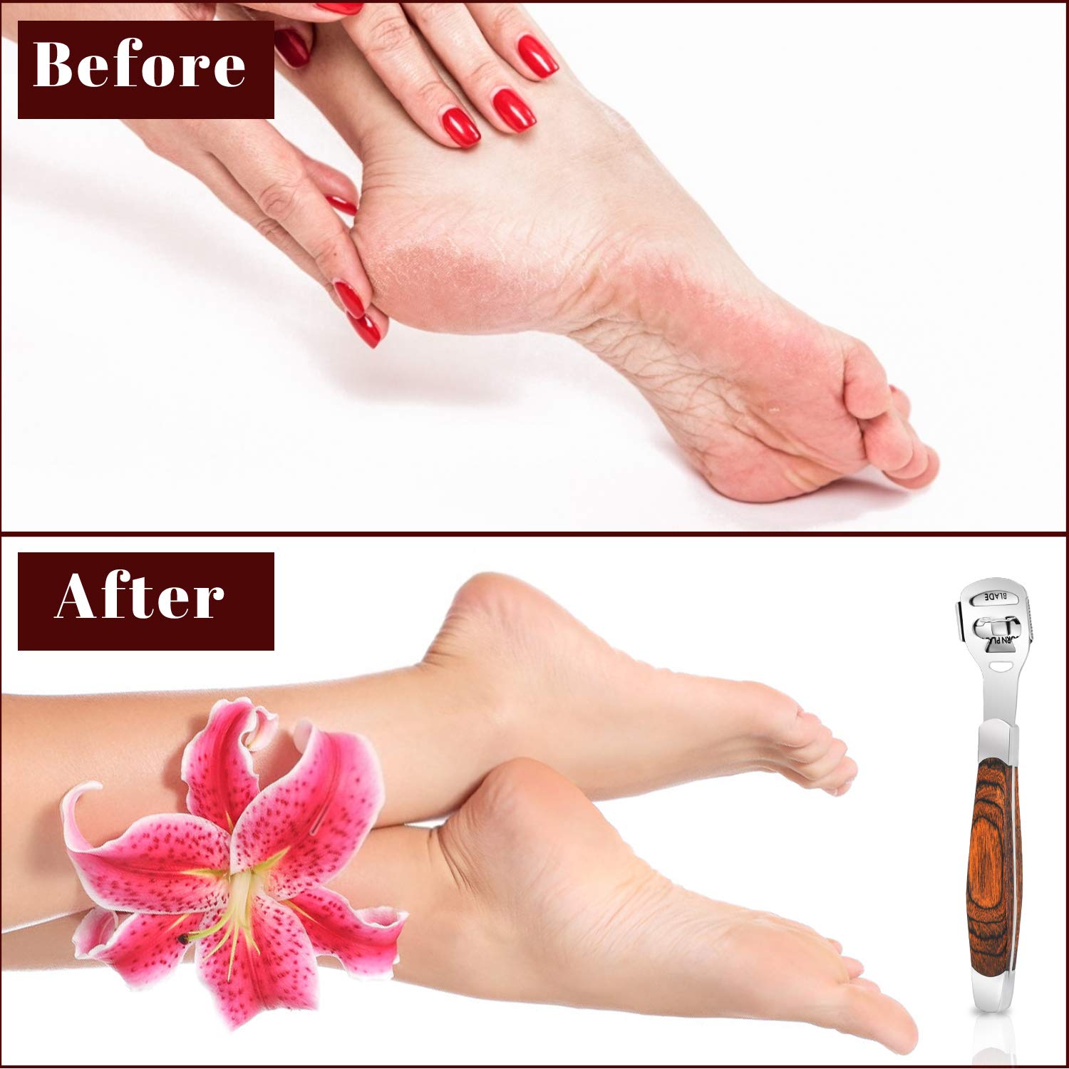 Foot Care Pedicure Callus Shaver Hard Skin Remover Wood Handle 10 Blades