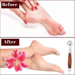 Foot Care Pedicure Callus Shaver Hard Skin Remover Wood Handle 10 Blades