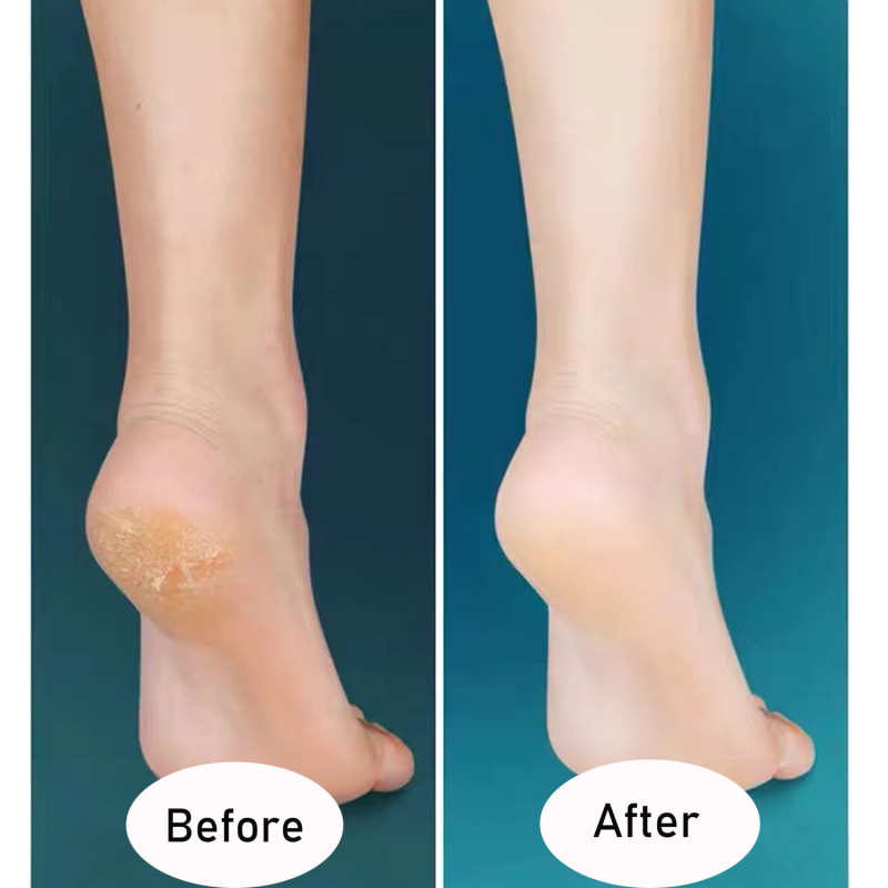 Glass Foot File Callus Remover, Crystal Pedicure Foot Scrubber for Travel Use, Portable Handheld Sized Foot Scraper for Cracked Heel