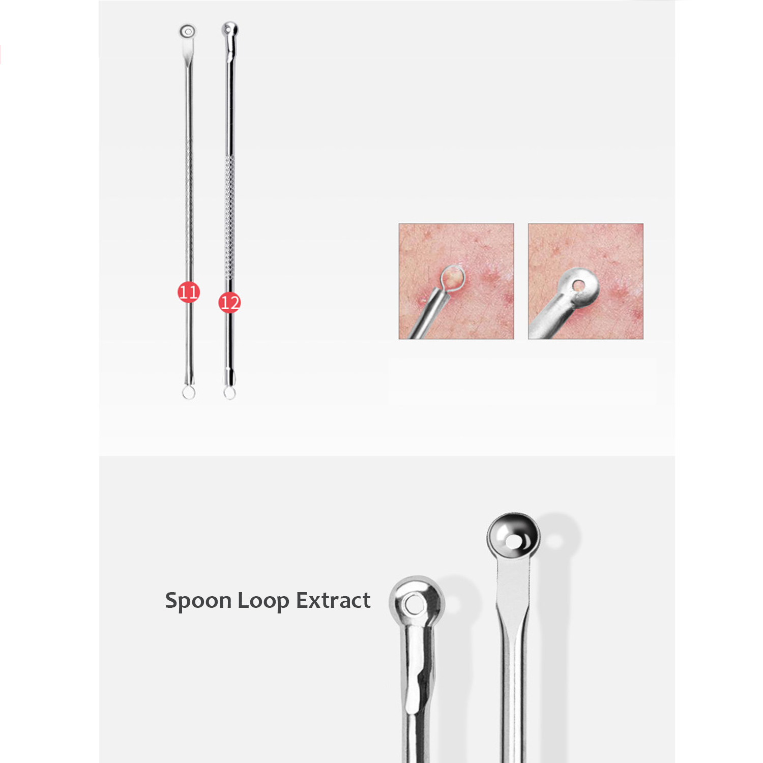 Acne Remover Tool Kit