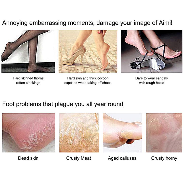 Pedicure Kit Professional Pedicure Tools Set Foot Care Scrubber Stainless Steel Pedicure Supplies Foot File Scraper Rasp Dead Skin Shaver Callus Remover