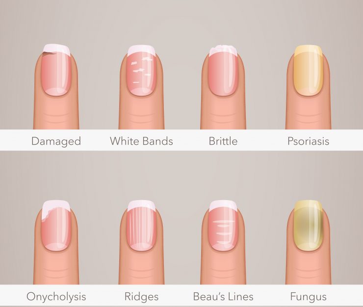 Tips on How To Grow Your Nails Faster and Stronger