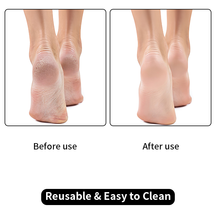 custom foot file