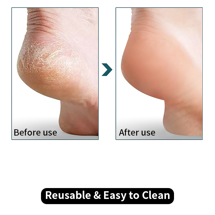 Callus Remover Wholesale