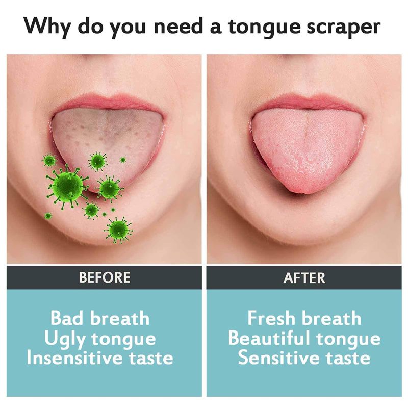 Metal Tongue Scraper Reduce Bad Breath Maintains Oral Care Cleaner Tool for Adults and Kids