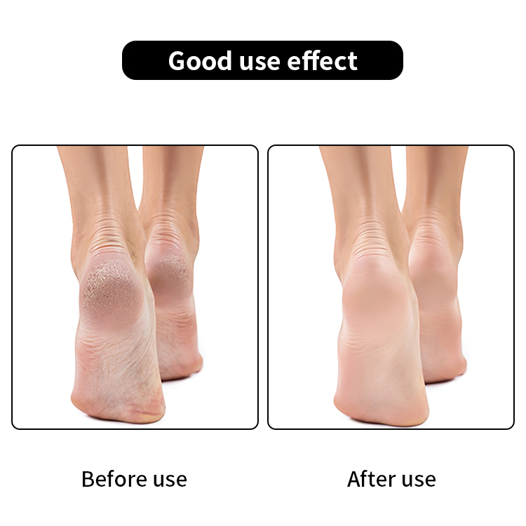 4Pcs Stainless Steel Pedicure Callus Remover Foot File