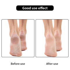 4Pcs Stainless Steel Pedicure Callus Remover Foot File