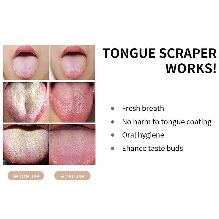 Professional Tongue Scraper for Oral Care Improve Bad Breath and Fresh Breath