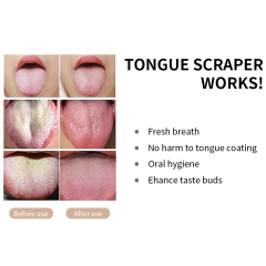 Professional Tongue Scraper for Oral Care Improve Bad Breath and Fresh Breath