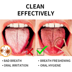 Stainless Steel Tongue Scraper With Plastic Handle Golden