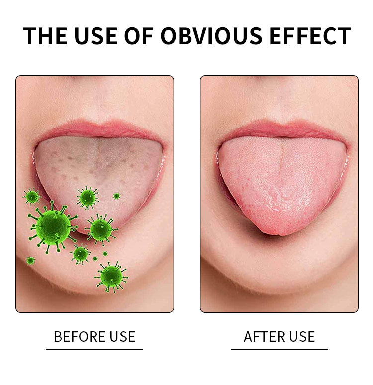 tongue scraper before and after