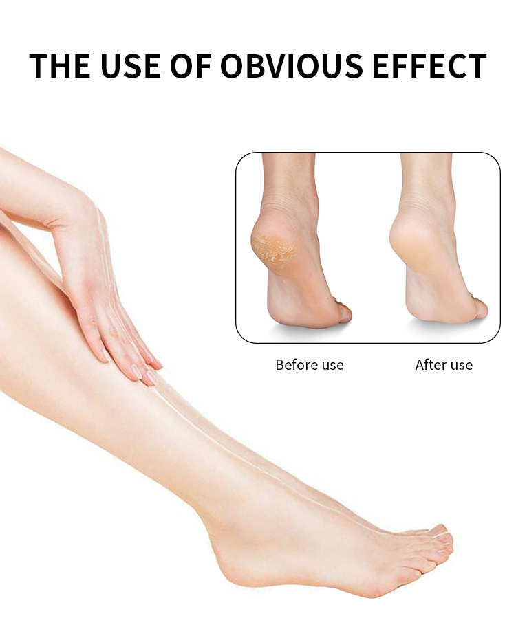 Dead Skin Exfoliator for Feet