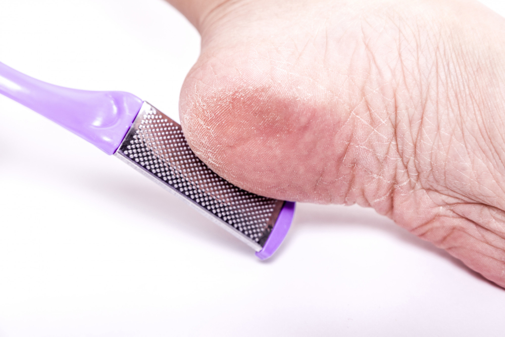 The Essential Foot Care Tools for Guys