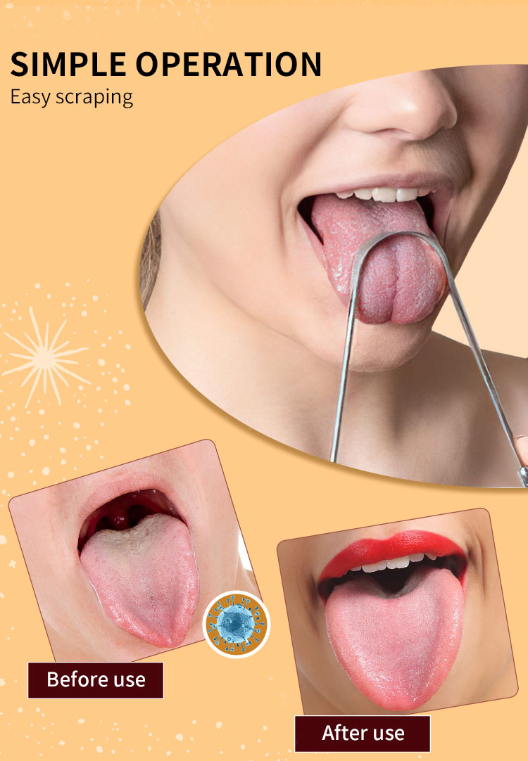 customized tongue scraper