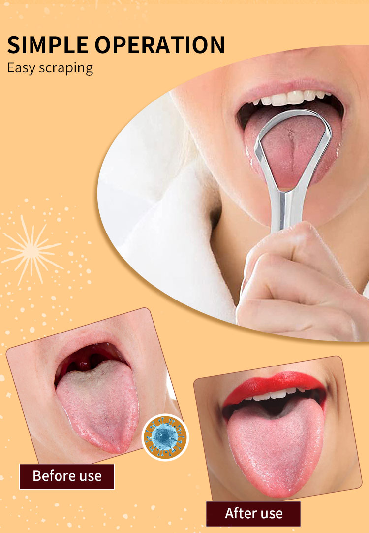 wholesale tongue cleaner