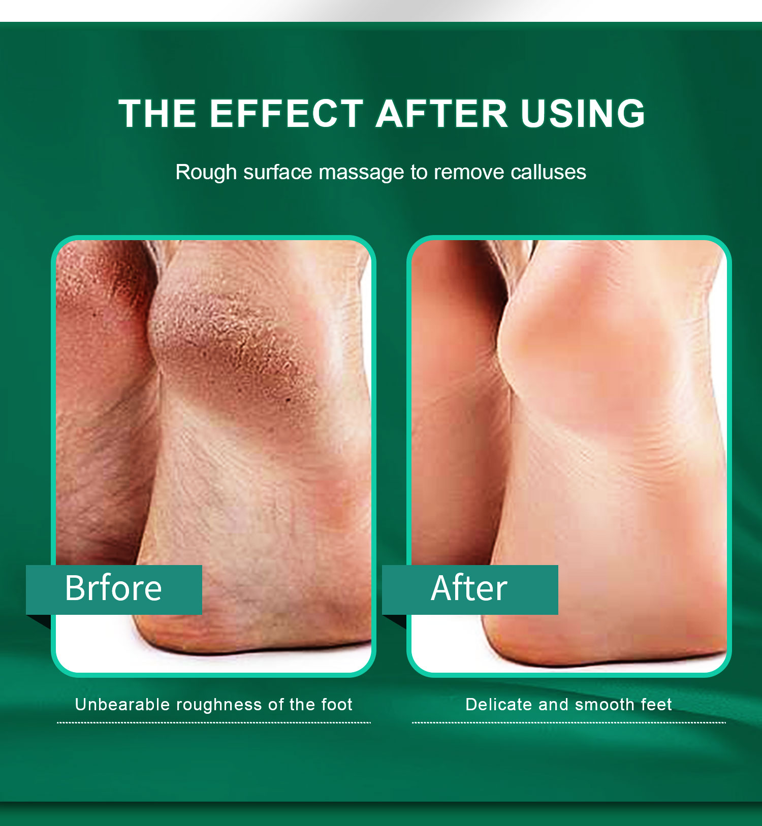 accessory for pedicure treatments. 