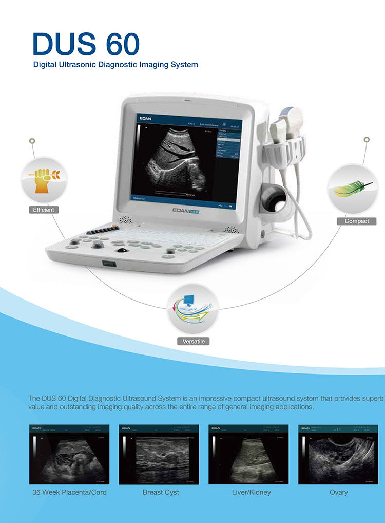 Echographe portable à ultrasons vétérinaire Edan DUS60-VET